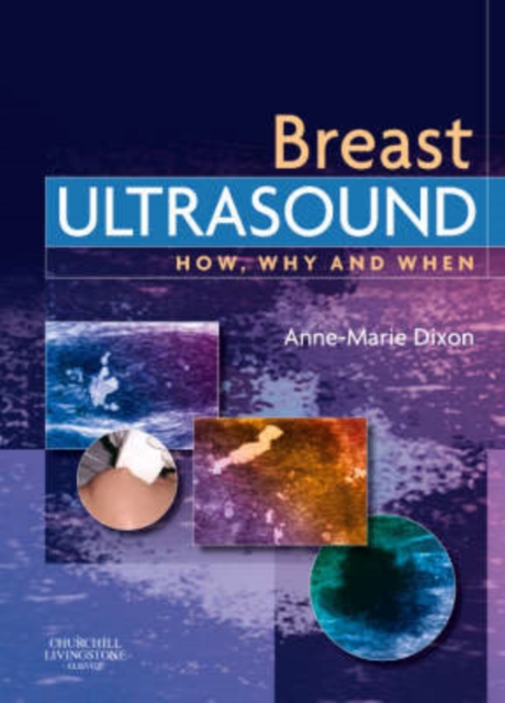 Breast Ultrasound : How, Why and When, Hardback Book