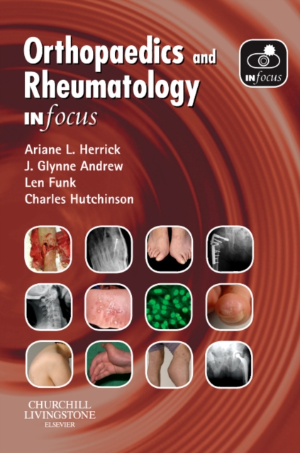 Orthopaedics and Rheumatology In Focus, Paperback / softback Book