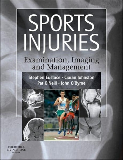 Sports Injuries : Examination, Imaging & Management, Hardback Book