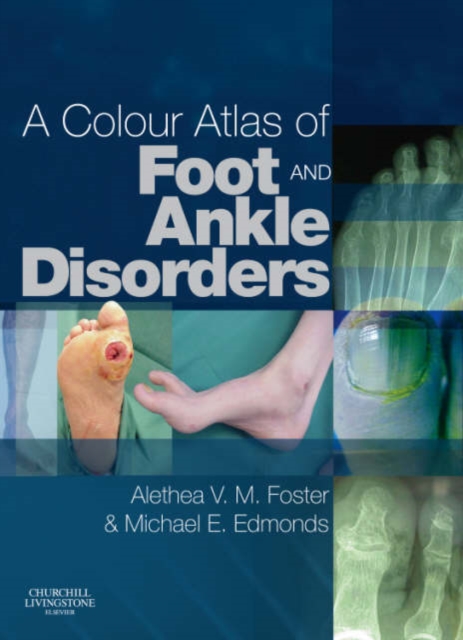 A Colour Atlas of Foot and Ankle Disorders, Hardback Book