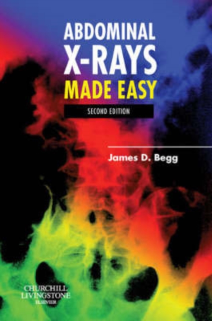Abdominal X-Rays Made Easy, Paperback / softback Book