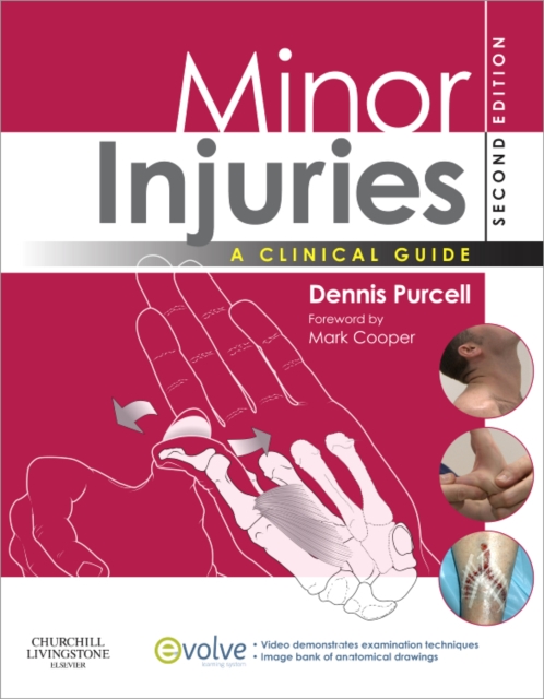 Minor Injuries : A Clinical Guide, Paperback Book