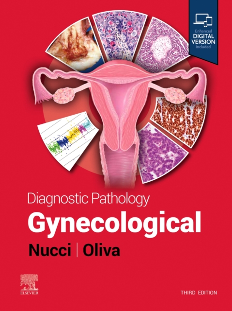 Diagnostic Pathology: Gynecological, Hardback Book
