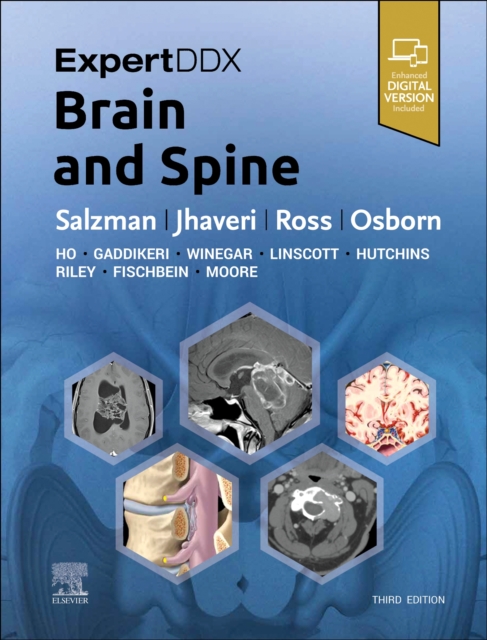 ExpertDDx: Brain and Spine, Hardback Book