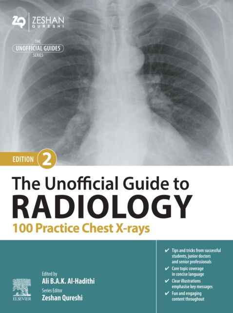 The Unofficial Guide to Radiology: 100 Practice Chest X-rays - E-Book, EPUB eBook