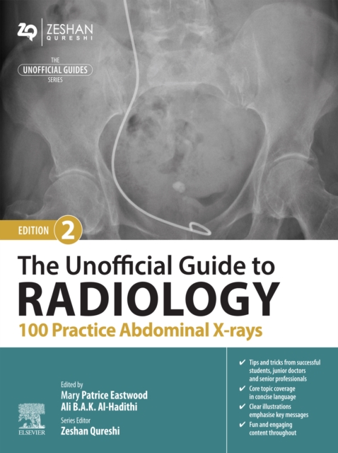 The Unofficial Guide to Radiology: 100 Practice Abdominal X-rays, EPUB eBook