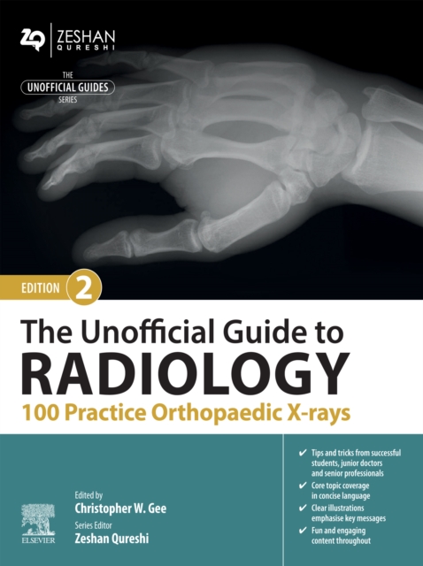 The Unofficial Guide to Radiology: 100 Practice Orthopaedic X-rays, EPUB eBook