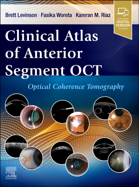 Clinical Atlas of Anterior Segment OCT: Optical Coherence Tomography, Hardback Book