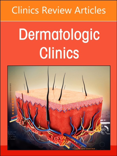 Psoriasis: Contemporary and Future Therapies, An Issue of Dermatologic Clinics : Volume 42-3, Hardback Book