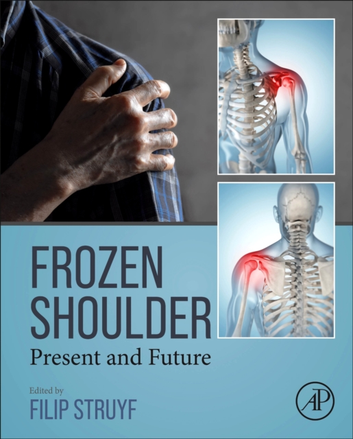 Frozen Shoulder : Present and Future, Hardback Book