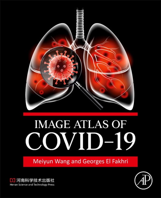 Image Atlas of COVID-19, Paperback / softback Book