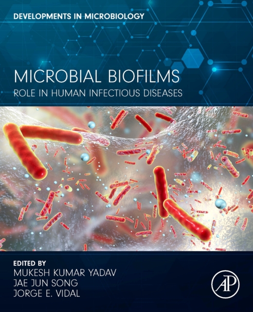 Microbial Biofilms : Role in Human Infectious Diseases, Paperback / softback Book
