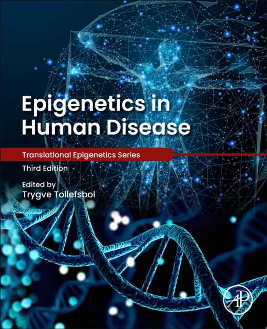 Epigenetics in Human Disease, Mixed media product Book
