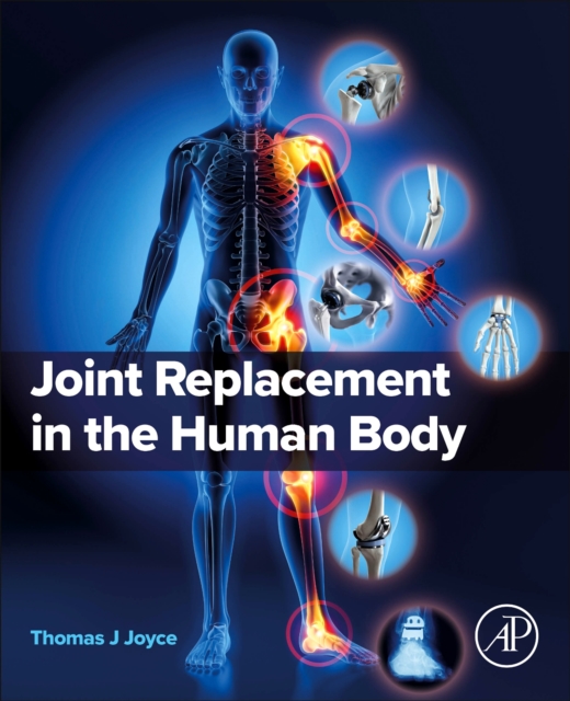 Joint Replacement in the Human Body, Paperback / softback Book