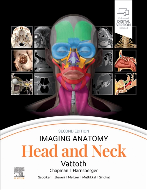 Imaging Anatomy: Head and Neck, Hardback Book