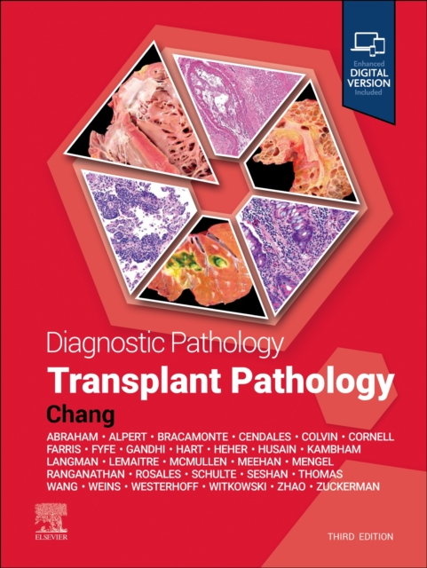 Diagnostic Pathology: Transplant Pathology, Hardback Book