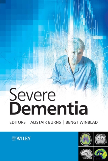 Severe Dementia, PDF eBook