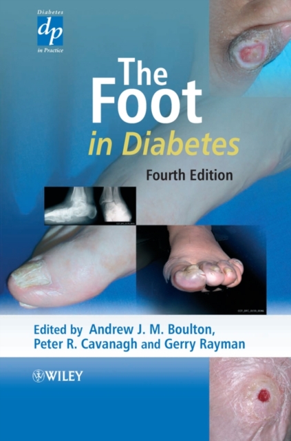 The Foot in Diabetes, Hardback Book
