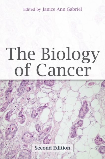 The Biology of Cancer, Paperback / softback Book