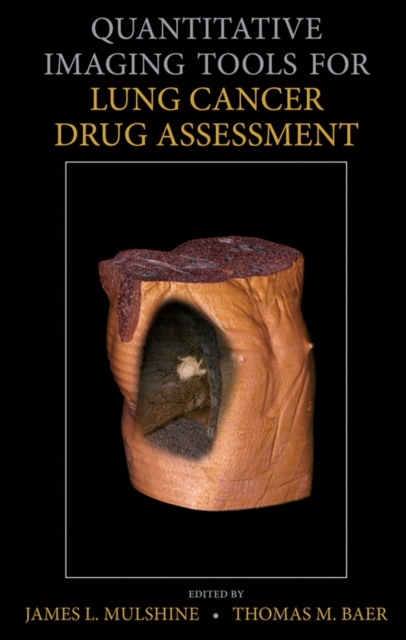 Quantitative Imaging Tools for Lung Cancer Drug Assessment, Hardback Book