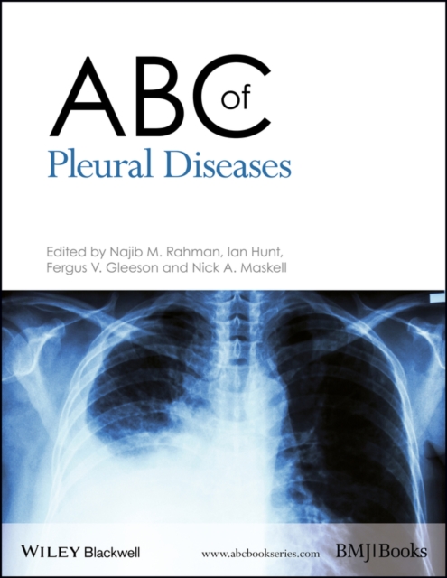 ABC of Pleural Diseases, Paperback / softback Book