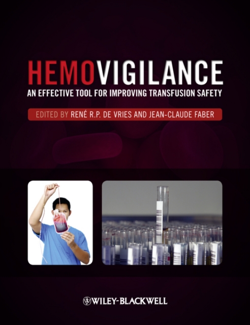 Hemovigilance : An Effective Tool for Improving Transfusion Safety, Hardback Book