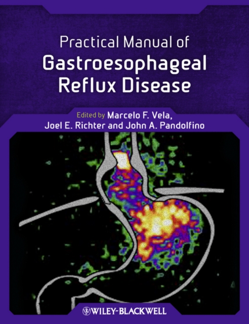 Practical Manual of Gastroesophageal Reflux Disease, Paperback / softback Book