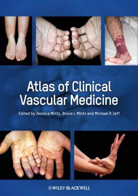 Atlas of Clinical Vascular Medicine, Hardback Book