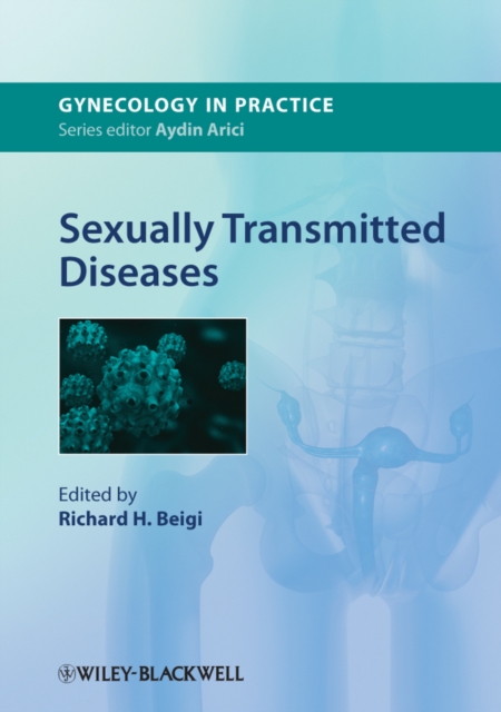 Sexually Transmitted Diseases, Paperback / softback Book