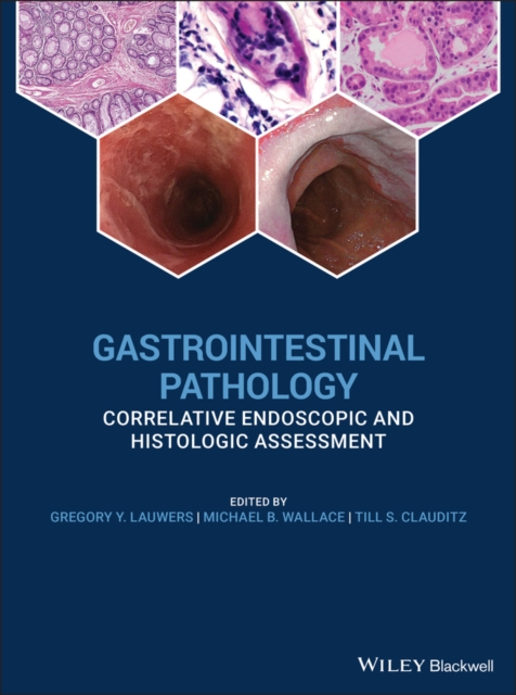 Gastrointestinal Pathology : Correlative Endoscopic and Histologic Assessment, Hardback Book