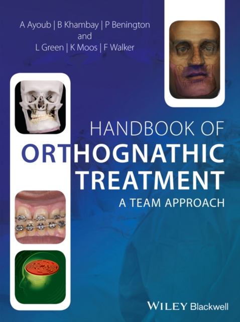 Handbook of Orthognathic Treatment : A Team Approach, Hardback Book