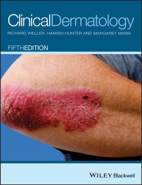 Clinical Dermatology, Paperback / softback Book
