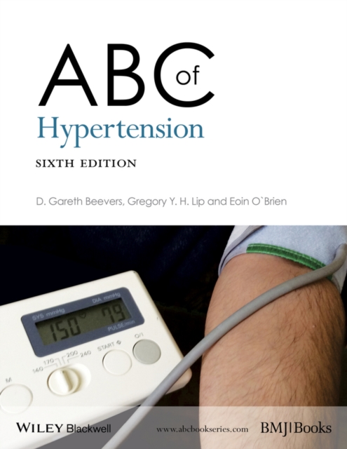 ABC of Hypertension, Paperback / softback Book