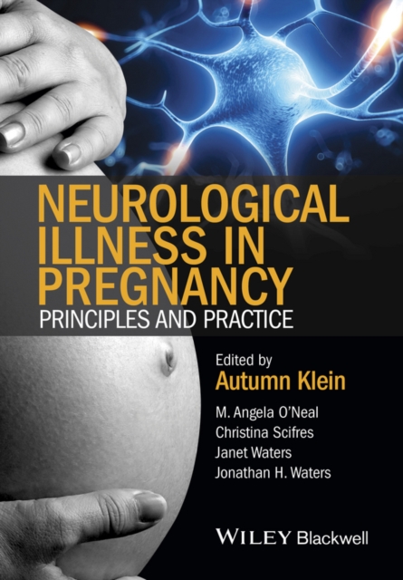 Neurological Illness in Pregnancy : Principles and Practice, Hardback Book
