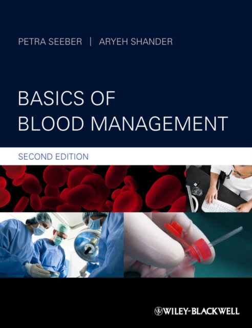Basics of Blood Management, Hardback Book