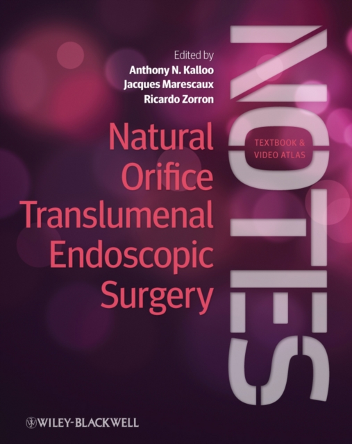 Natural Orifice Translumenal Endoscopic Surgery (NOTES), Textbook and Video Atlas, Hardback Book