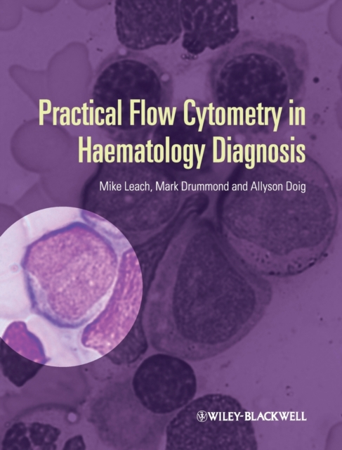 Practical Flow Cytometry in Haematology Diagnosis, Hardback Book