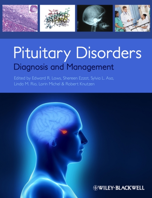 Pituitary Disorders : Diagnosis and Management, Paperback / softback Book
