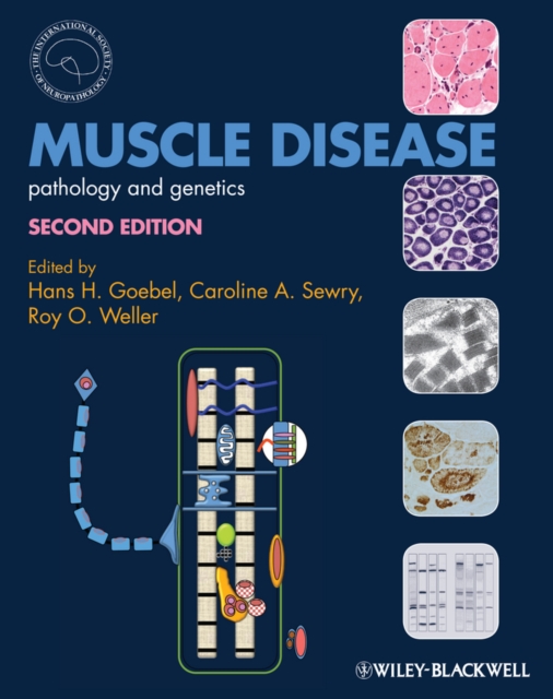 Muscle Disease : Pathology and Genetics, Hardback Book