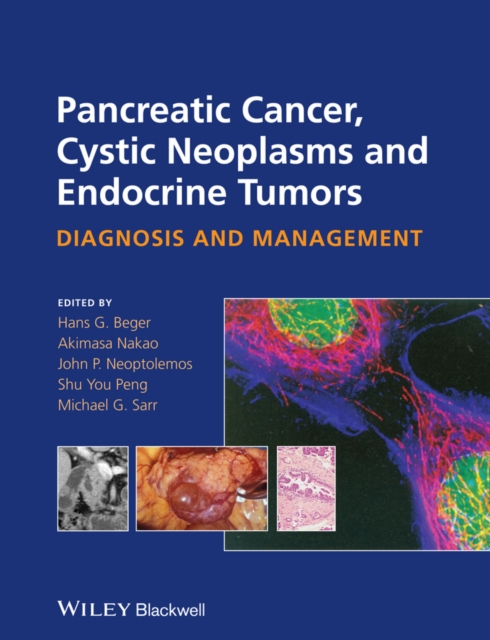 Pancreatic Cancer, Cystic Neoplasms and Endocrine Tumors : Diagnosis and Management, Hardback Book