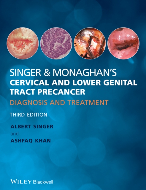 Singer and Monaghan's Cervical and Lower Genital Tract Precancer : Diagnosis and Treatment, Hardback Book