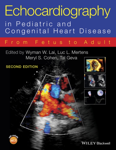 Echocardiography in Pediatric and Congenital Heart Disease : From Fetus to Adult, Hardback Book