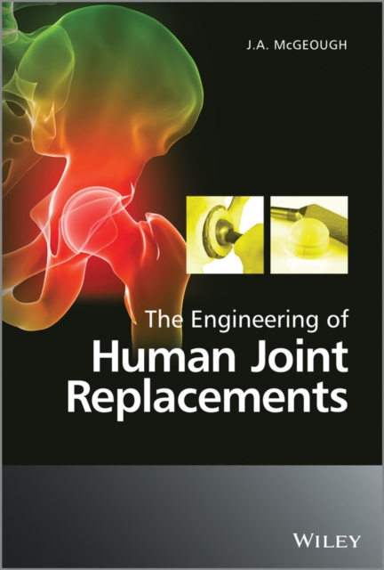 The Engineering of Human Joint Replacements, Hardback Book