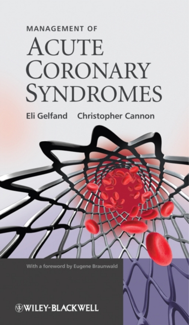 Management of Acute Coronary Syndromes, PDF eBook