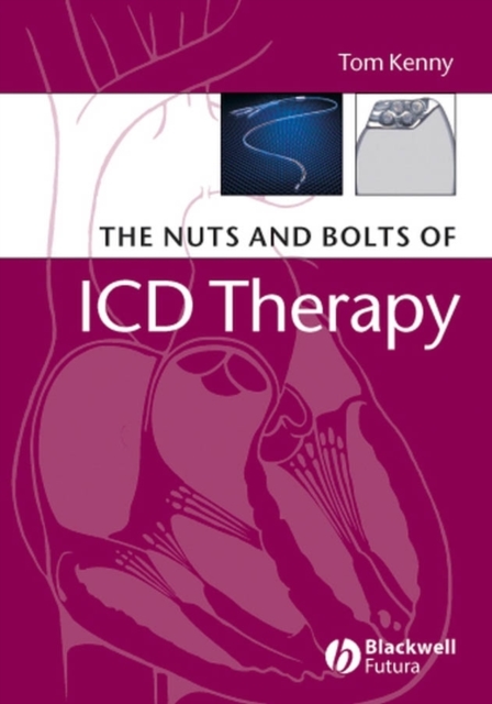 The Nuts and Bolts of ICD Therapy, PDF eBook