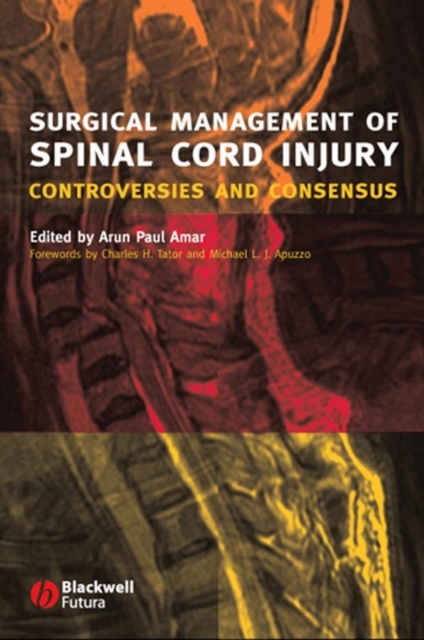 Surgical Management of Spinal Cord Injury : Controversies and Consensus, PDF eBook