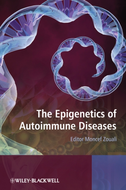 The Epigenetics of Autoimmune Diseases, Hardback Book
