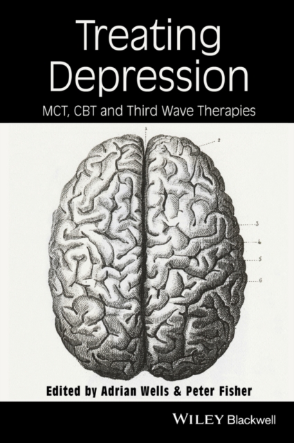Treating Depression : MCT, CBT, and Third Wave Therapies, Hardback Book