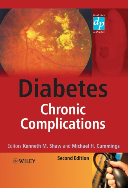 Diabetes : Chronic Complications, PDF eBook