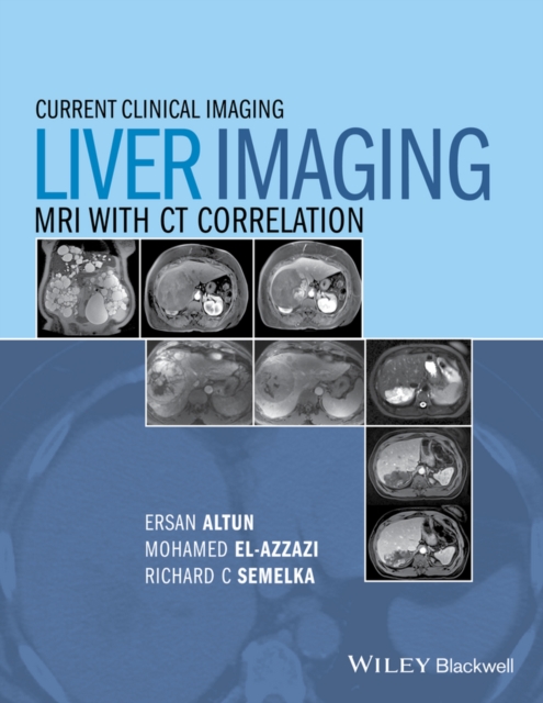 Liver Imaging : MRI with CT Correlation, Hardback Book